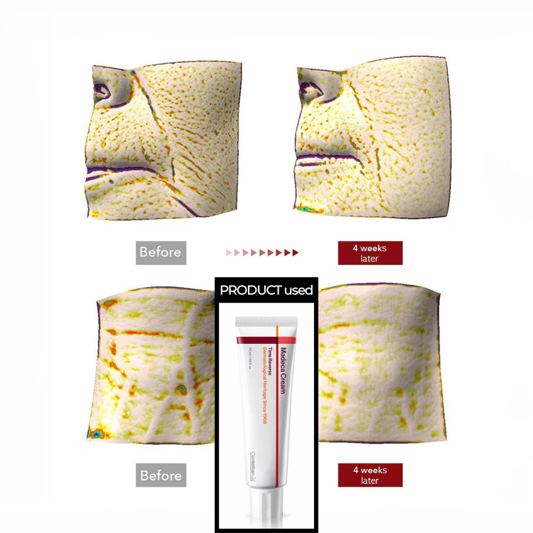 HUE_CALM® X Centellian24 Cream Collab